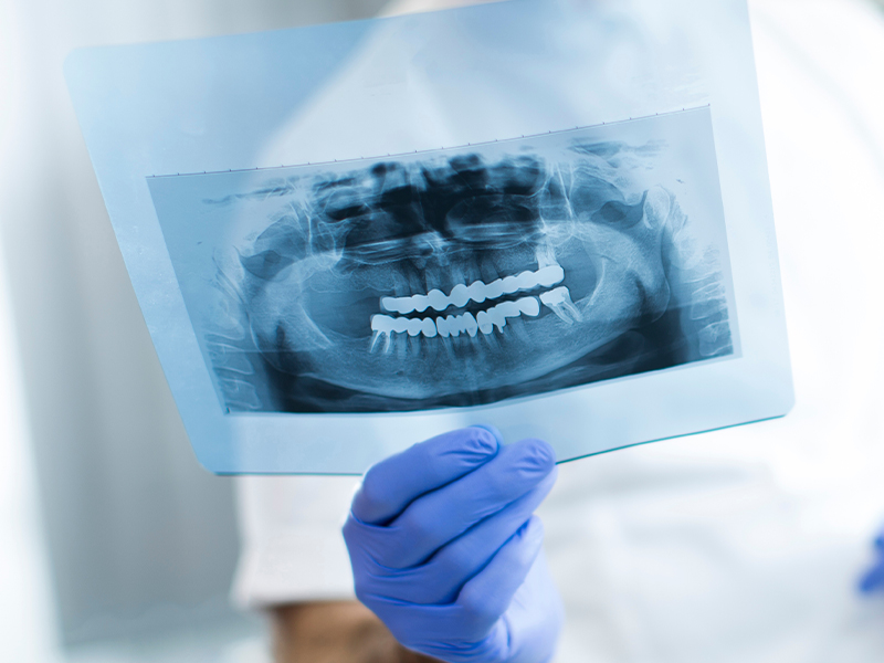 Oral Surgery Office in Akron