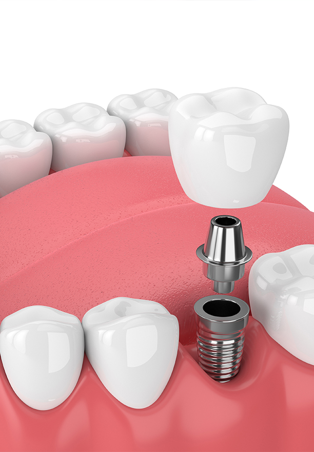 Oral Surgery Office in Akron