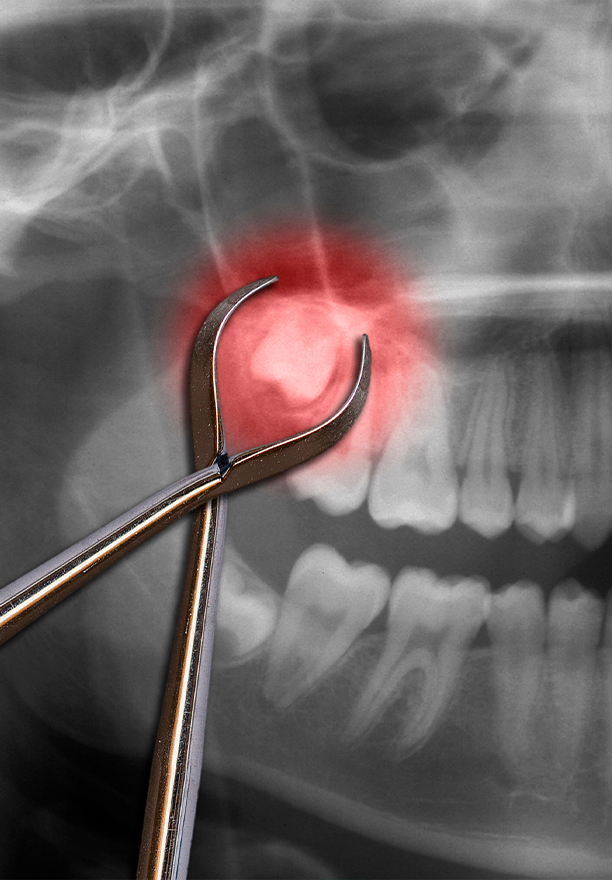 Facial Reconstruction near Akron